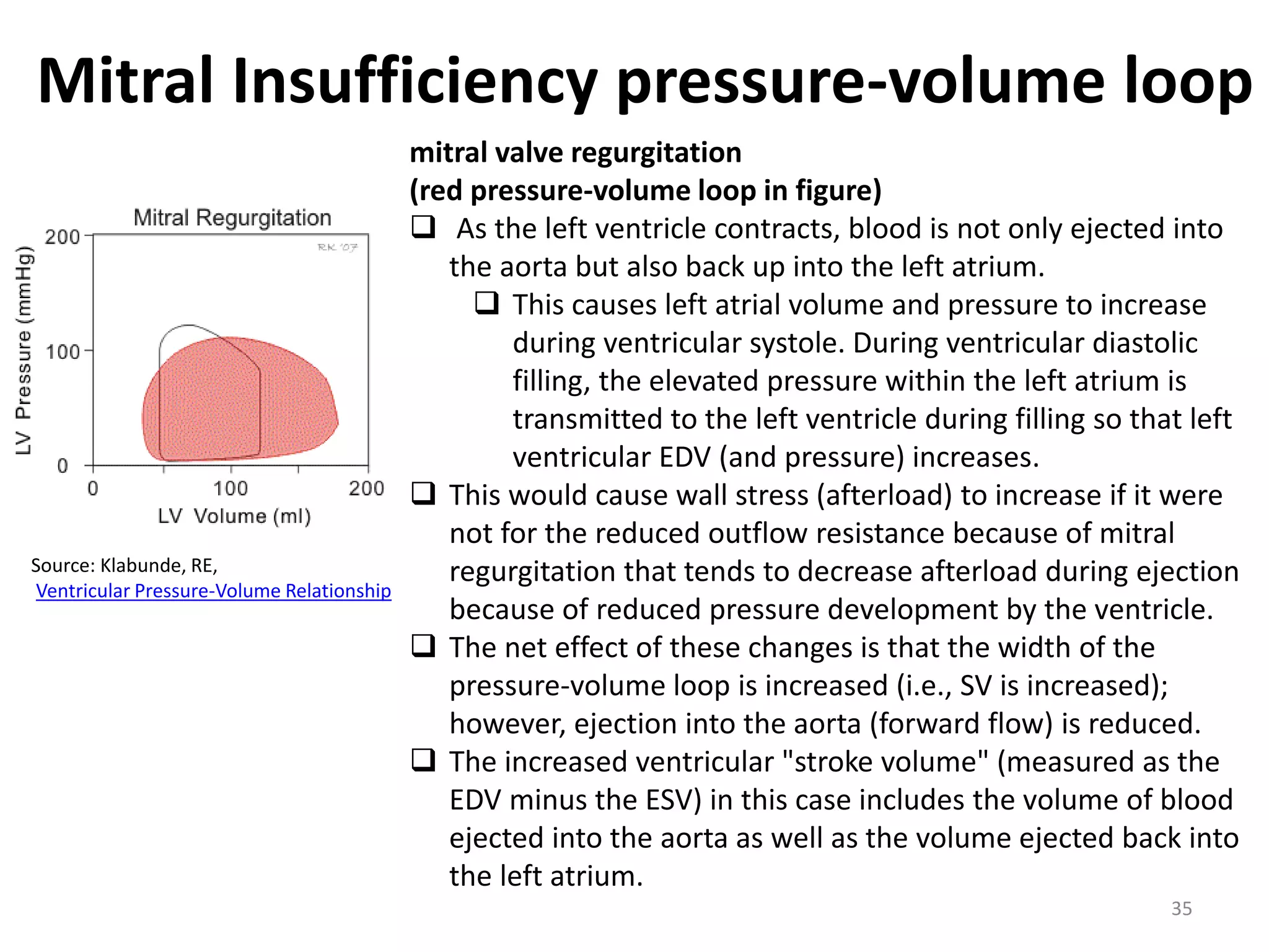 Mitral Insufficiency pressure-volume loop

Source: Klabunde, RE,
Ventricular Pressure-Volume Relationship

mitral valve regurgitation
(red pressure-volume loop in figure)
 As the left ventricle contracts, blood is not only ejected into
the aorta but also back up into the left atrium.
 This causes left atrial volume and pressure to increase
during ventricular systole. During ventricular diastolic
filling, the elevated pressure within the left atrium is
transmitted to the left ventricle during filling so that left
ventricular EDV (and pressure) increases.
 This would cause wall stress (afterload) to increase if it were
not for the reduced outflow resistance because of mitral
regurgitation that tends to decrease afterload during ejection
because of reduced pressure development by the ventricle.
 The net effect of these changes is that the width of the
pressure-volume loop is increased (i.e., SV is increased);
however, ejection into the aorta (forward flow) is reduced.
 The increased ventricular "stroke volume" (measured as the
EDV minus the ESV) in this case includes the volume of blood
ejected into the aorta as well as the volume ejected back into
the left atrium.
35

 