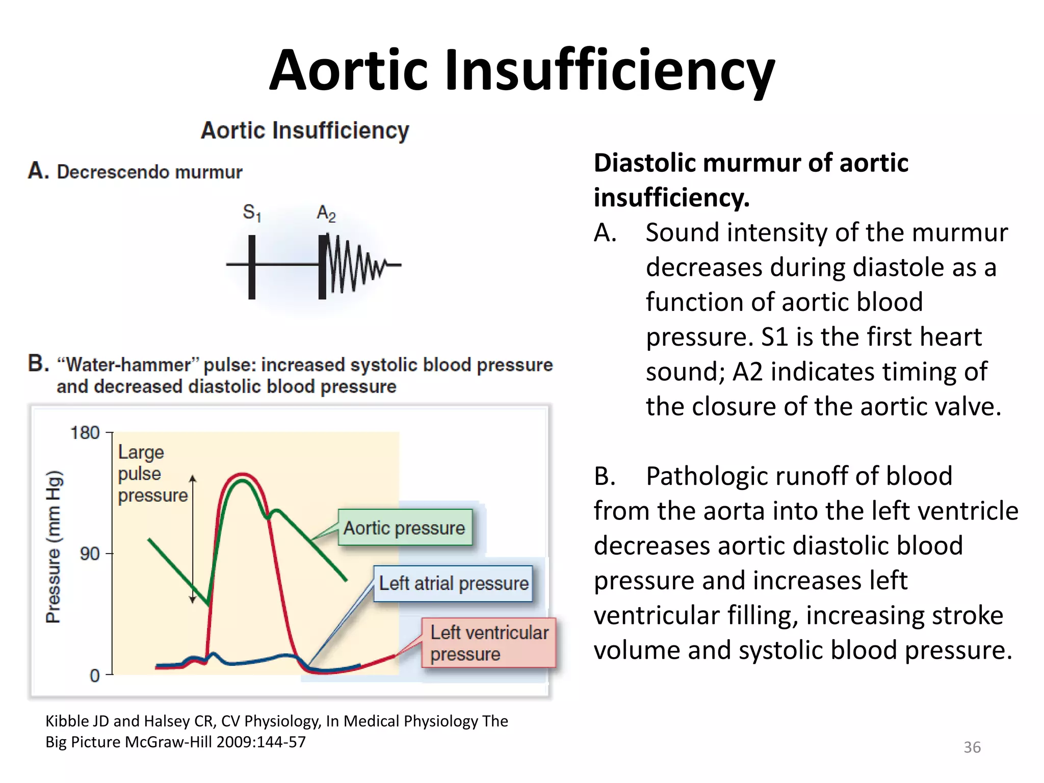 Aortic Insufficiency
Diastolic murmur of aortic
insufficiency.
A. Sound intensity of the murmur
decreases during diastole as a
function of aortic blood
pressure. S1 is the first heart
sound; A2 indicates timing of
the closure of the aortic valve.
B. Pathologic runoff of blood
from the aorta into the left ventricle
decreases aortic diastolic blood
pressure and increases left
ventricular filling, increasing stroke
volume and systolic blood pressure.
Kibble JD and Halsey CR, CV Physiology, In Medical Physiology The
Big Picture McGraw-Hill 2009:144-57

36

 
