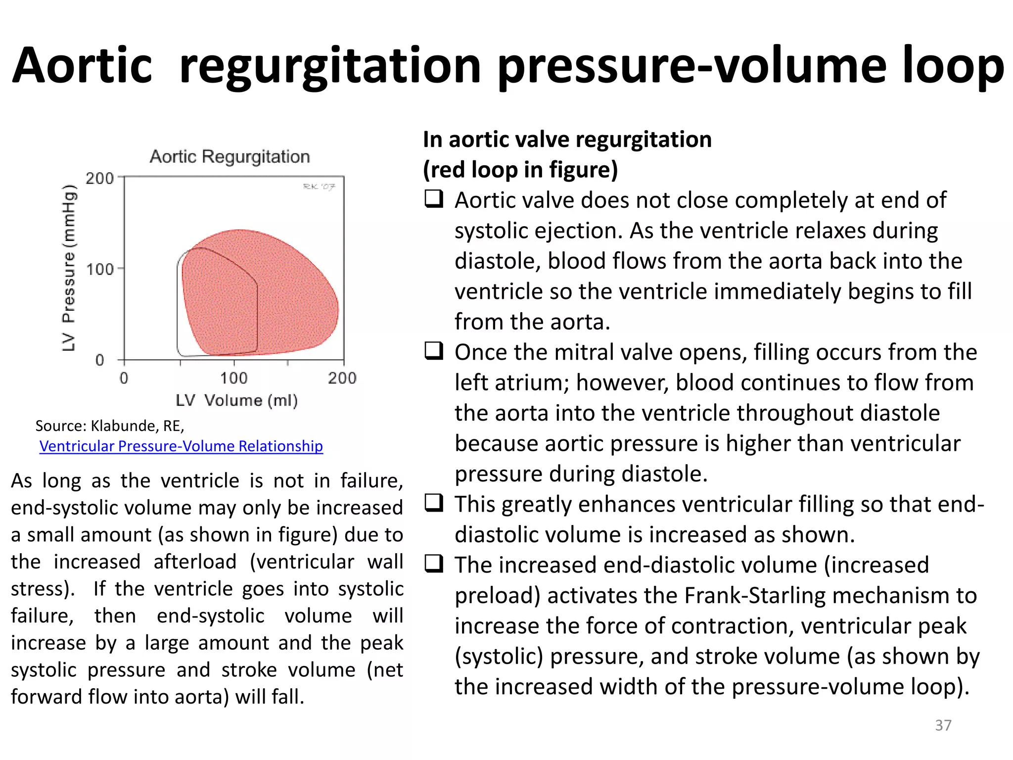 Aortic regurgitation pressure-volume loop

Source: Klabunde, RE,
Ventricular Pressure-Volume Relationship

As long as the ventricle is not in failure,
end-systolic volume may only be increased
a small amount (as shown in figure) due to
the increased afterload (ventricular wall
stress). If the ventricle goes into systolic
failure, then end-systolic volume will
increase by a large amount and the peak
systolic pressure and stroke volume (net
forward flow into aorta) will fall.

In aortic valve regurgitation
(red loop in figure)
 Aortic valve does not close completely at end of
systolic ejection. As the ventricle relaxes during
diastole, blood flows from the aorta back into the
ventricle so the ventricle immediately begins to fill
from the aorta.
 Once the mitral valve opens, filling occurs from the
left atrium; however, blood continues to flow from
the aorta into the ventricle throughout diastole
because aortic pressure is higher than ventricular
pressure during diastole.
 This greatly enhances ventricular filling so that enddiastolic volume is increased as shown.
 The increased end-diastolic volume (increased
preload) activates the Frank-Starling mechanism to
increase the force of contraction, ventricular peak
(systolic) pressure, and stroke volume (as shown by
the increased width of the pressure-volume loop).
37

 