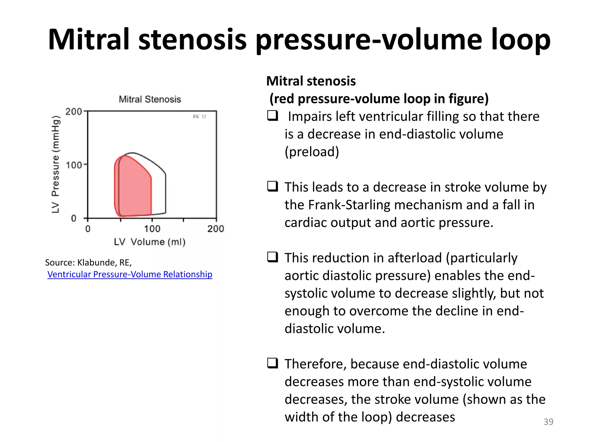 Mitral stenosis pressure-volume loop
Mitral stenosis
(red pressure-volume loop in figure)
 Impairs left ventricular filling so that there
is a decrease in end-diastolic volume
(preload)
 This leads to a decrease in stroke volume by
the Frank-Starling mechanism and a fall in
cardiac output and aortic pressure.
Source: Klabunde, RE,
Ventricular Pressure-Volume Relationship

 This reduction in afterload (particularly
aortic diastolic pressure) enables the endsystolic volume to decrease slightly, but not
enough to overcome the decline in enddiastolic volume.
 Therefore, because end-diastolic volume
decreases more than end-systolic volume
decreases, the stroke volume (shown as the
width of the loop) decreases
39

 
