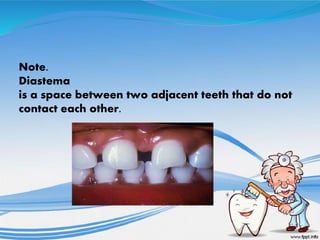 Note.
Diastema
is a space between two adjacent teeth that do not
contact each other.
 