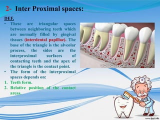 2- Inter Proximal spaces:
DEF.
• These are triangular spaces
between neighboring teeth which
are normally filled by gingival
tissues (interdental papillae). The
base of the triangle is the alveolar
process, the sides are the
interproximal surfaces of
contacting teeth and the apex of
the triangle is the contact point.
• The form of the interproximal
spaces depends on:
1. Teeth form.
2. Relative position of the contact
areas.
 