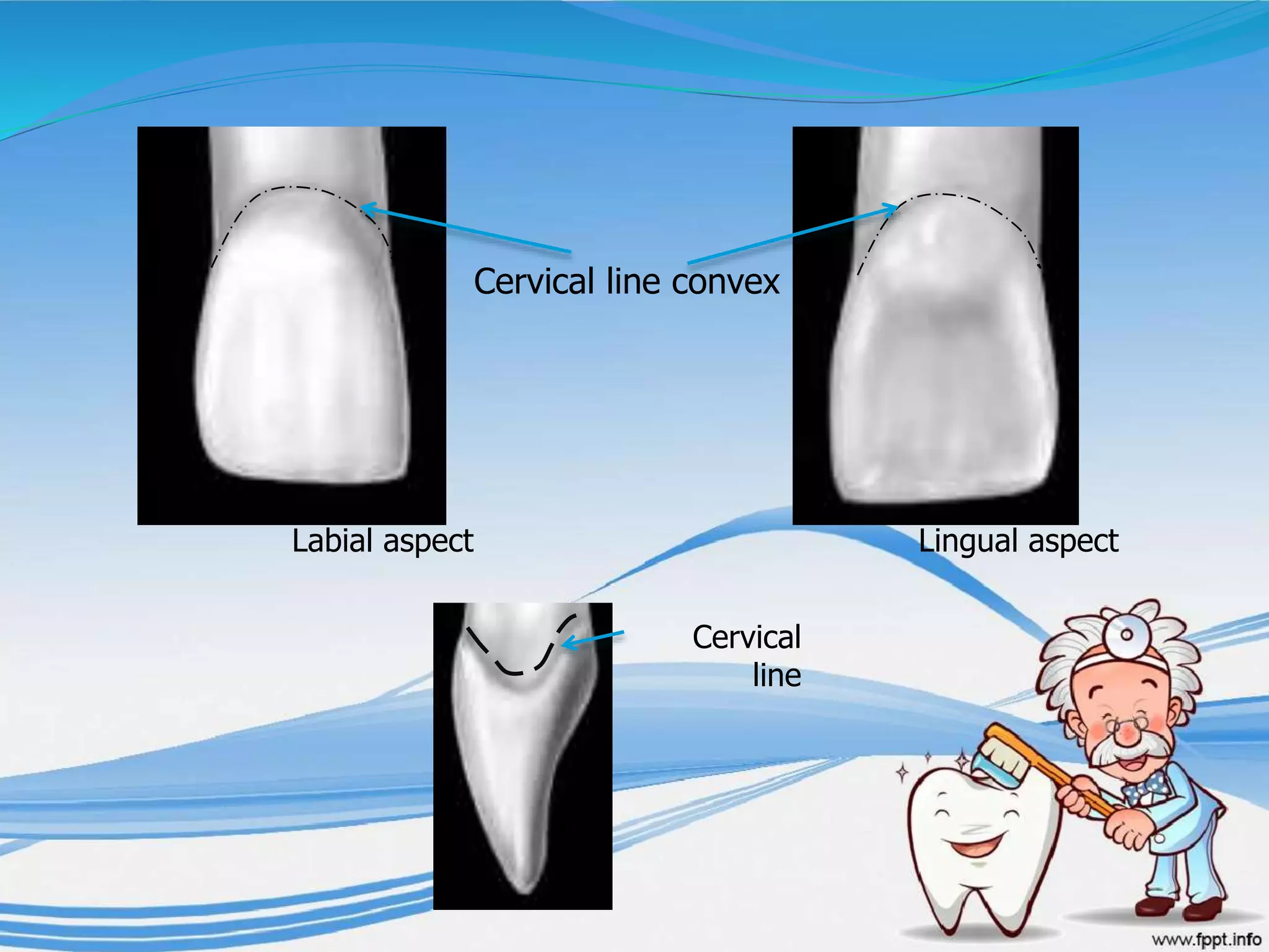 Cervical line convex
Lingual aspectLabial aspect
Cervical
line
 