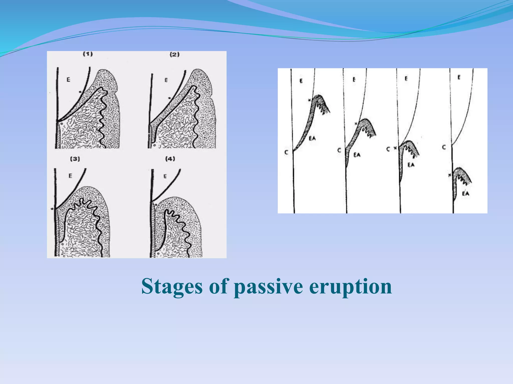 Stages of passive eruption
 