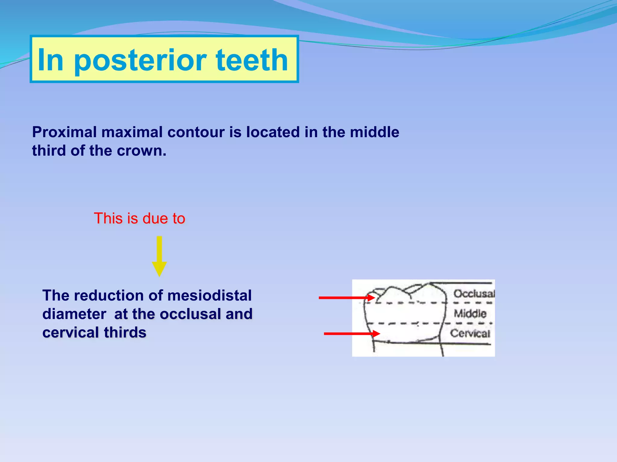 The reduction of mesiodistal
diameter at the occlusal and
cervical thirds
In posterior teeth
Proximal maximal contour is located in the middle
third of the crown.
This is due to
 