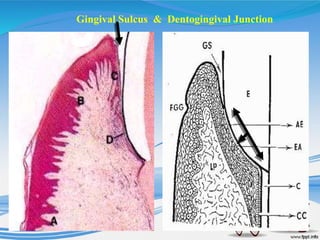 Gingival Sulcus & Dentogingival Junction
 
