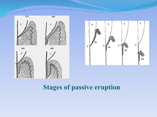 Stages of passive eruption
 