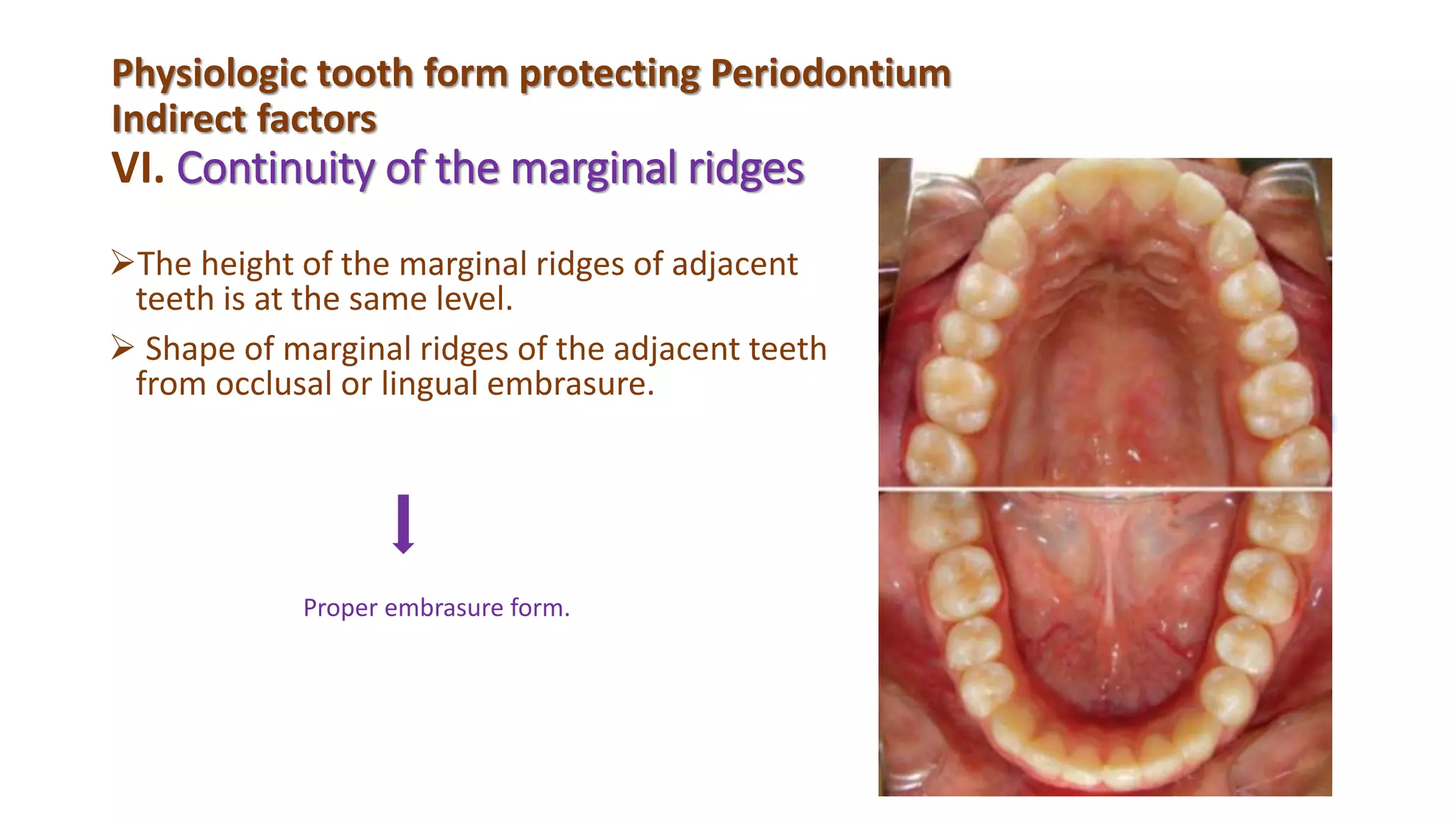Marginal Ridge On Tooth Physiologic tooth from ii | PPTX