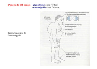 L’excès de GH cause:   gigantisme chez l’enfant
                       acromégalie chez l’adulte.




Traits typiques de
l’acromégalie
 