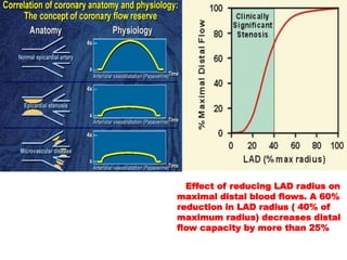 Effect of reducing LAD radius on
maximal distal blood flows. A 60%
reduction in LAD radius ( 40% of
maximum radius) decreases distal
flow capacity by more than 25%
 