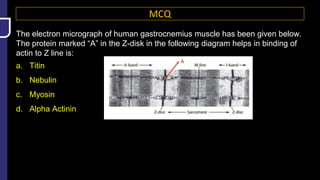 MCQ
The electron micrograph of human gastrocnemius muscle has been given below.
The protein marked “A” in the Z-disk in the following diagram helps in binding of
actin to Z line is:
a. Titin
b. Nebulin
c. Myosin
d. Alpha Actinin
 