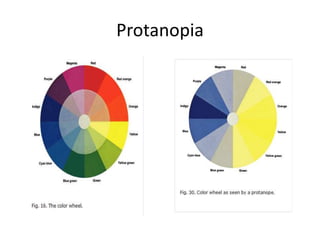 Physiology of colour vision | PPTX