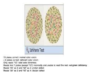 Physiology of colour vision | PPTX