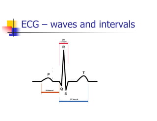 ECG – waves and intervals
 