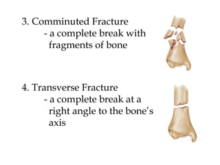 Complete Break Physiology ch 7 lecture notes | PPT