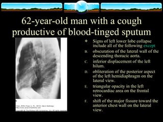 Triangular Sign Chest Physiology of Chest X-Ray | PPT