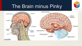 The Brain minus Pinky
 