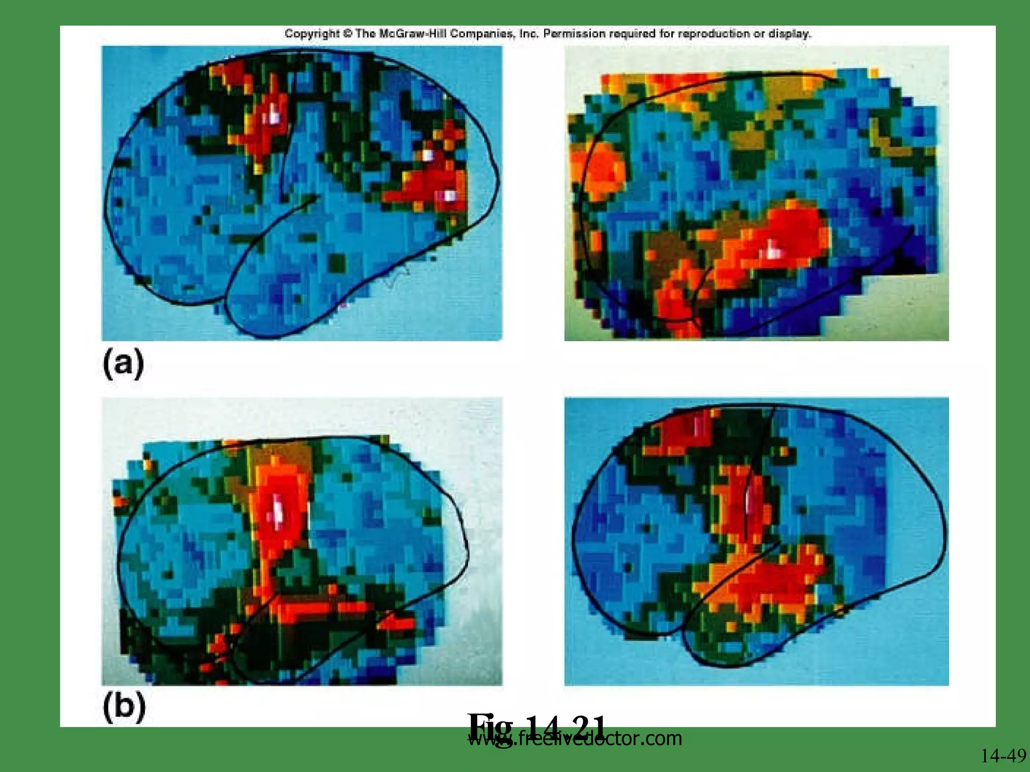 Fig 14.21 14-49 www.freelivedoctor.com 