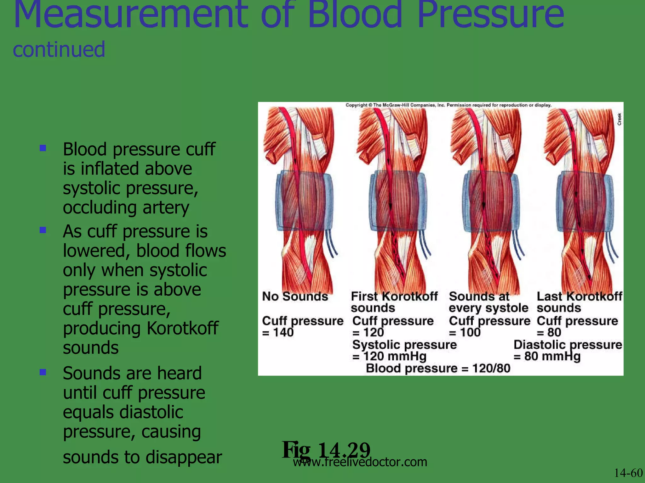 Measurement of Blood Pressure  continued Blood pressure cuff is inflated above systolic pressure, occluding artery  As cuff pressure is lowered, blood flows only when systolic pressure is above cuff pressure, producing Korotkoff sounds  Sounds are heard until cuff pressure equals diastolic pressure, causing sounds to disappear   Fig 14.29 14-60 www.freelivedoctor.com 