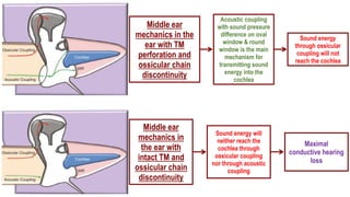 PHYSIOLOGY OF HEARING.pptx