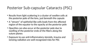 Physiology of Human Crystalline Lens _ppt | PPTX