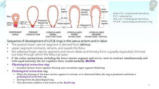 Pathologic Retraction Ring Physiology of labor april 2021 | PDF