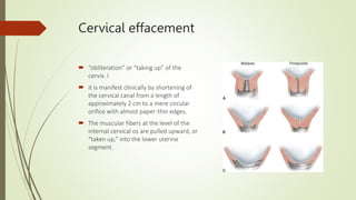 Cervical effacement
 “obliteration” or “taking up” of the
cervix. I
 it is manifest clinically by shortening of
the cervical canal from a length of
approximately 2 cm to a mere circular
orifice with almost paper-thin edges.
 The muscular fibers at the level of the
internal cervical os are pulled upward, or
“taken up,” into the lower uterine
segment.
 