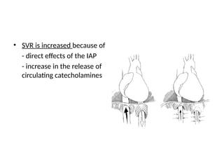 Increased Svr Physiology of laparoscopy.pptx Physiology of laparoscopy.pptx