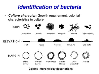 Identification of bacteria
• Culture character: Growth requirement, colonial
characteristics in culture
Colony morphology descriptions
 