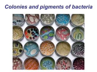 Colonies and pigments of bacteria
 