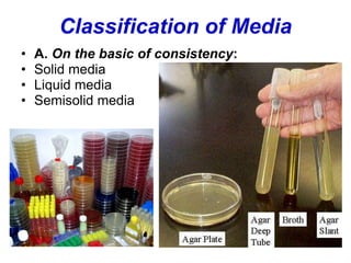 Classification of Media
• A. On the basic of consistency:
• Solid media
• Liquid media
• Semisolid media
 