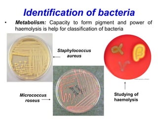 Colonies and pigments of bacteria
 