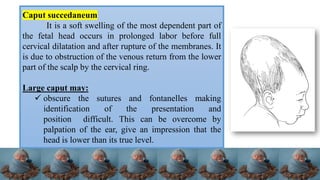 Feto-pelvic relationship and physiology of normal labor.pdf