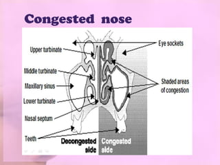 Congested nose
 