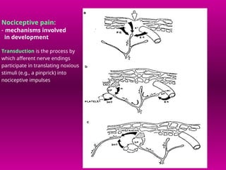Comprehensive Overview of Pain Pathophysiology and Neuroanatomy | PPT