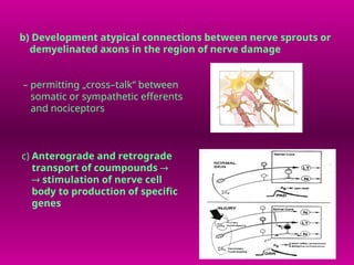 Comprehensive Overview of Pain Pathophysiology and Neuroanatomy | PPT