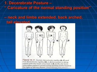 Normal Standing Physiology of posture movementand equilibrium | PPT