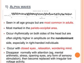Physiology of sleep and E.E.G for undergraduates | PPTX