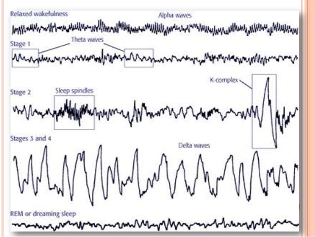 Physiology of sleep and E.E.G for undergraduates