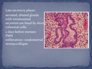  Late secretory phase:
 serrated, dilated glands
with intraluminal
secretion are lined by short
columnar cells.
 2 days before menses:
PMN
infilitration→endometrial
stroma collapse
 
