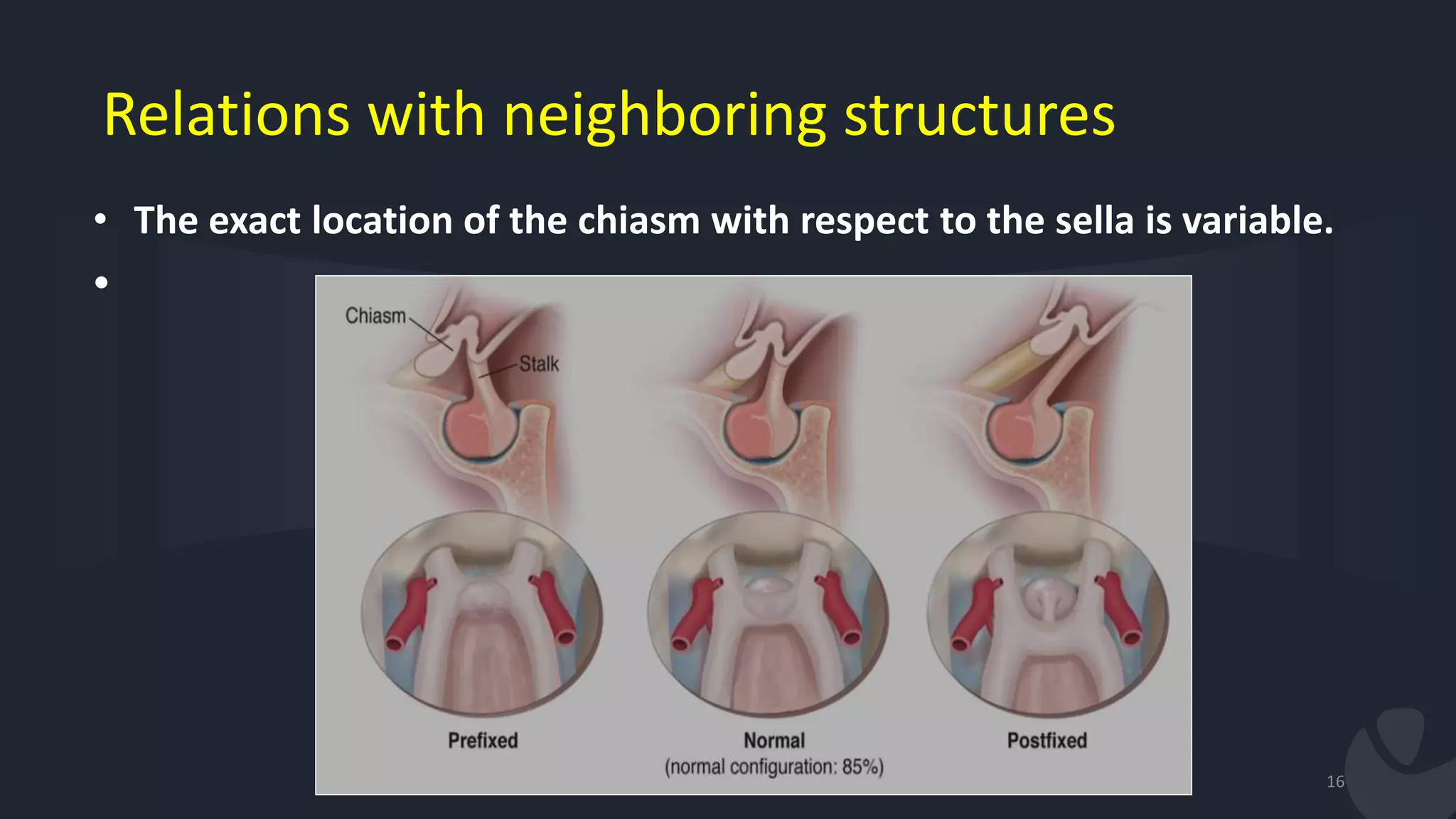 Relations with neighboring structures
• The exact location of the chiasm with respect to the sella is variable.
•
16
 