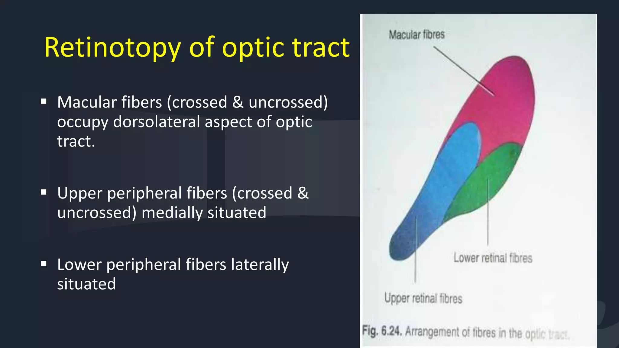 Retinotopy of optic tract
 Macular fibers (crossed & uncrossed)
occupy dorsolateral aspect of optic
tract.
 Upper peripheral fibers (crossed &
uncrossed) medially situated
 Lower peripheral fibers laterally
situated
19
 