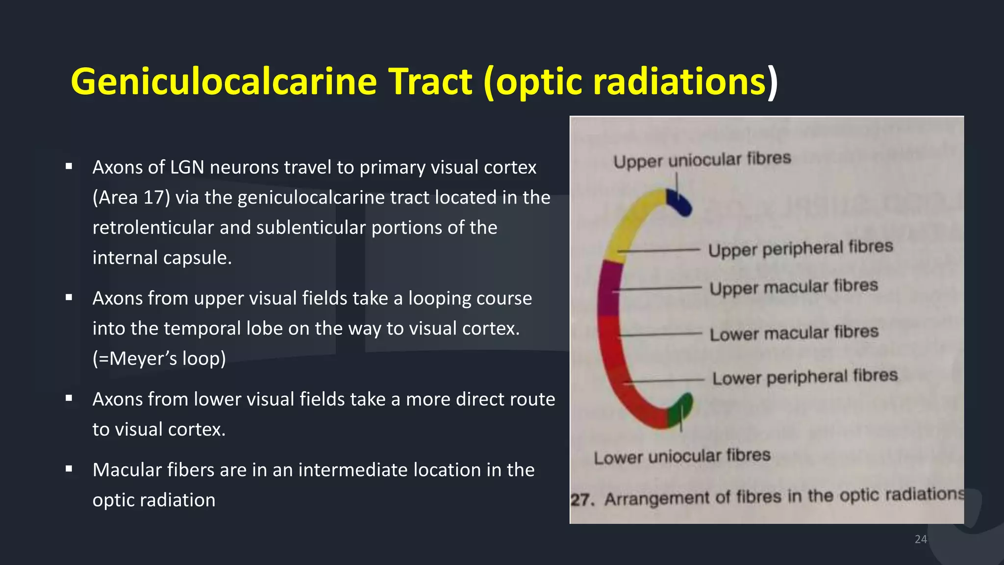 Geniculocalcarine Tract (optic radiations)
 Axons of LGN neurons travel to primary visual cortex
(Area 17) via the geniculocalcarine tract located in the
retrolenticular and sublenticular portions of the
internal capsule.
 Axons from upper visual fields take a looping course
into the temporal lobe on the way to visual cortex.
(=Meyer’s loop)
 Axons from lower visual fields take a more direct route
to visual cortex.
 Macular fibers are in an intermediate location in the
optic radiation
24
 