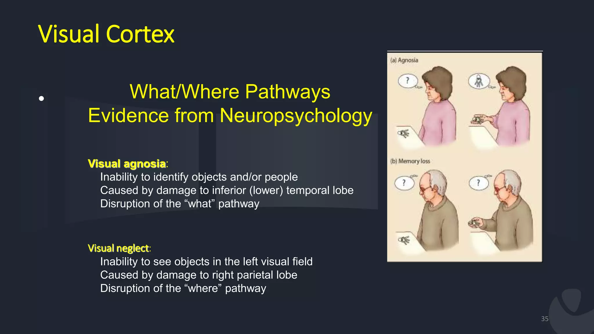 Visual Cortex
•
35
What/Where Pathways
Evidence from Neuropsychology
Visual agnosia:
Inability to identify objects and/or people
Caused by damage to inferior (lower) temporal lobe
Disruption of the “what” pathway
Visual neglect:
Inability to see objects in the left visual field
Caused by damage to right parietal lobe
Disruption of the “where” pathway
 