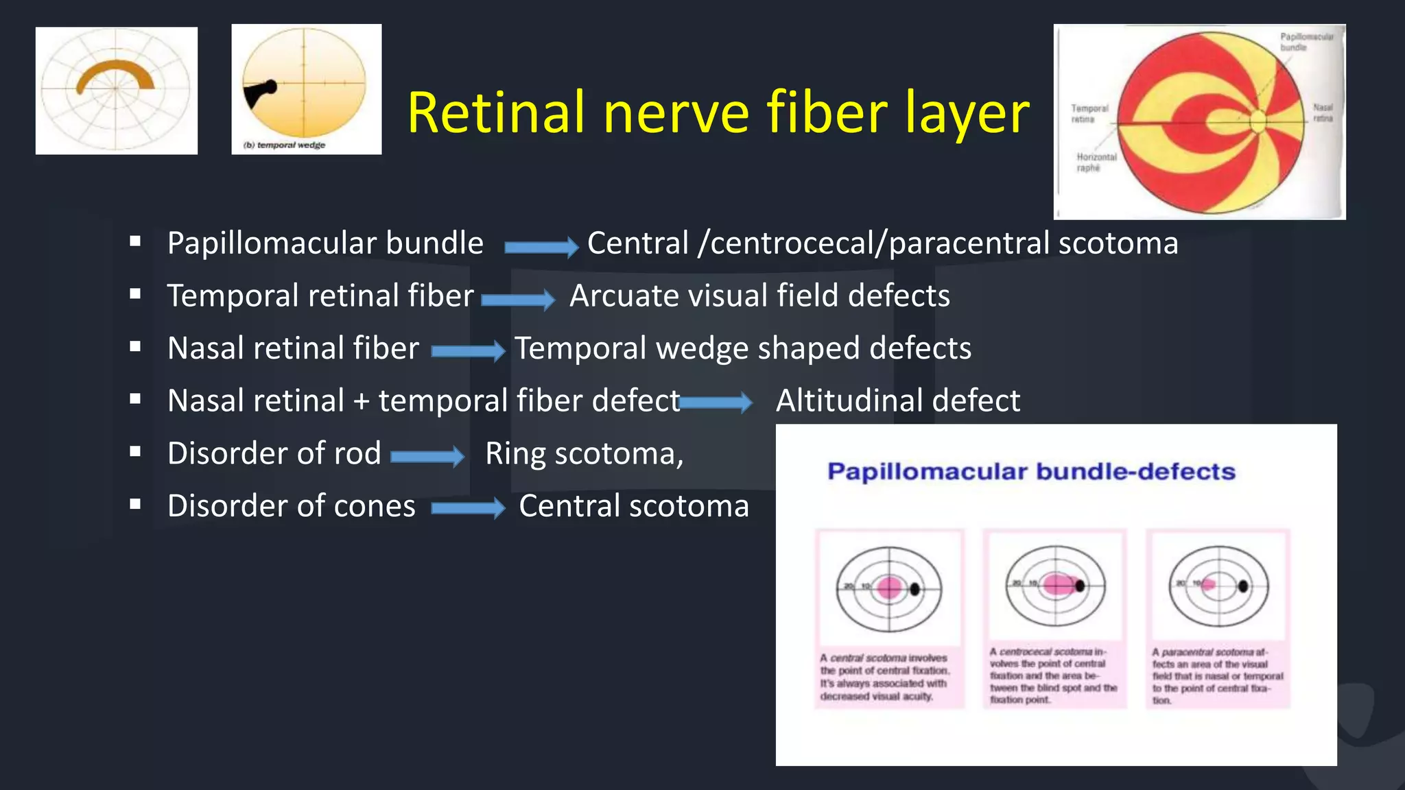 Retinal nerve fiber layer
 Papillomacular bundle Central /centrocecal/paracentral scotoma
 Temporal retinal fiber Arcuate visual field defects
 Nasal retinal fiber Temporal wedge shaped defects
 Nasal retinal + temporal fiber defect Altitudinal defect
 Disorder of rod Ring scotoma,
 Disorder of cones Central scotoma
57
 