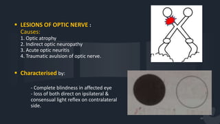 Physiology of the visual pathway & cerebral integration | PPTX