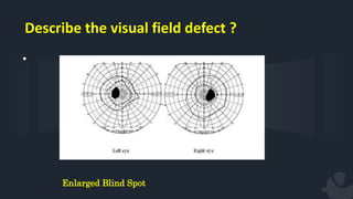 Physiology of the visual pathway & cerebral integration | PPTX