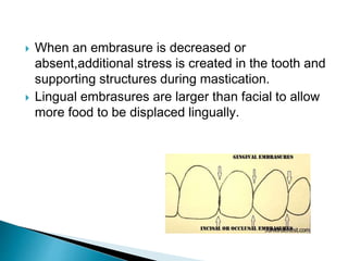  When an embrasure is decreased or
absent,additional stress is created in the tooth and
supporting structures during mastication.
 Lingual embrasures are larger than facial to allow
more food to be displaced lingually.
 