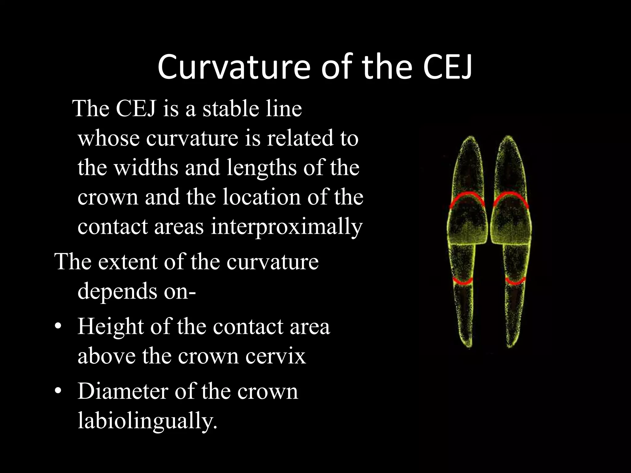 Curvature of the CEJ
The CEJ is a stable line
whose curvature is related to
the widths and lengths of the
crown and the location of the
contact areas interproximally
The extent of the curvature
depends on• Height of the contact area
above the crown cervix
• Diameter of the crown
labiolingually.

 