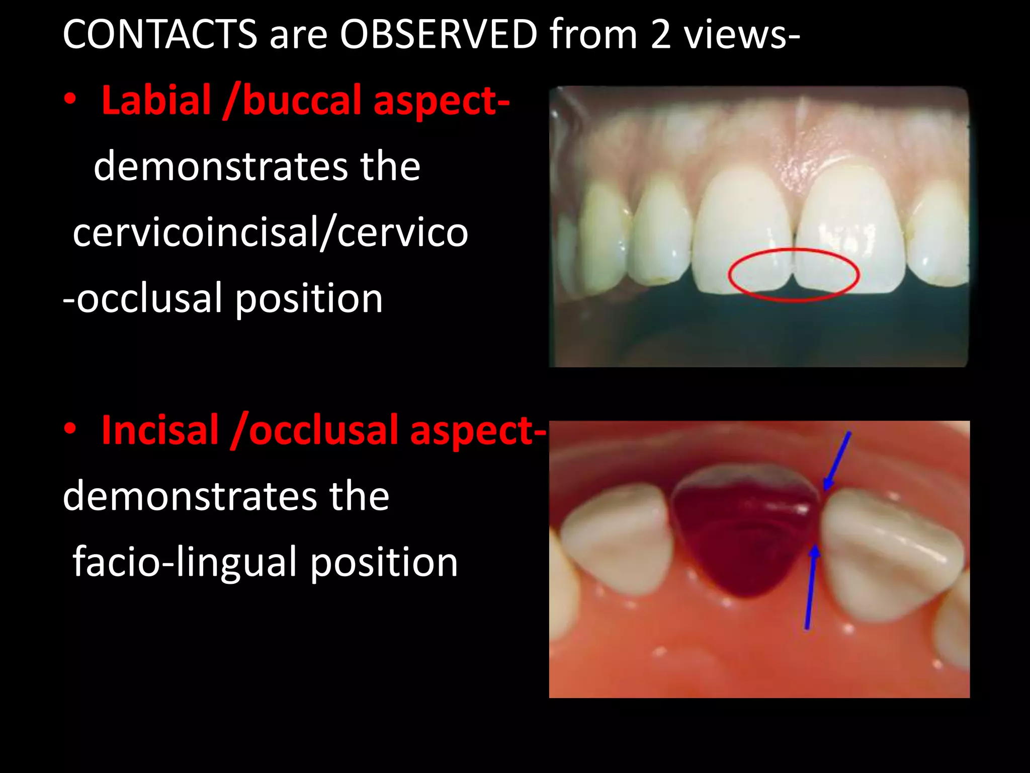 dental anatomy & physiology of permanent teeth | PPTX